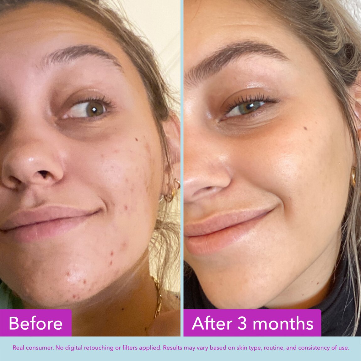 niacinamide-brightening-toner-a4 zb_p.jpg