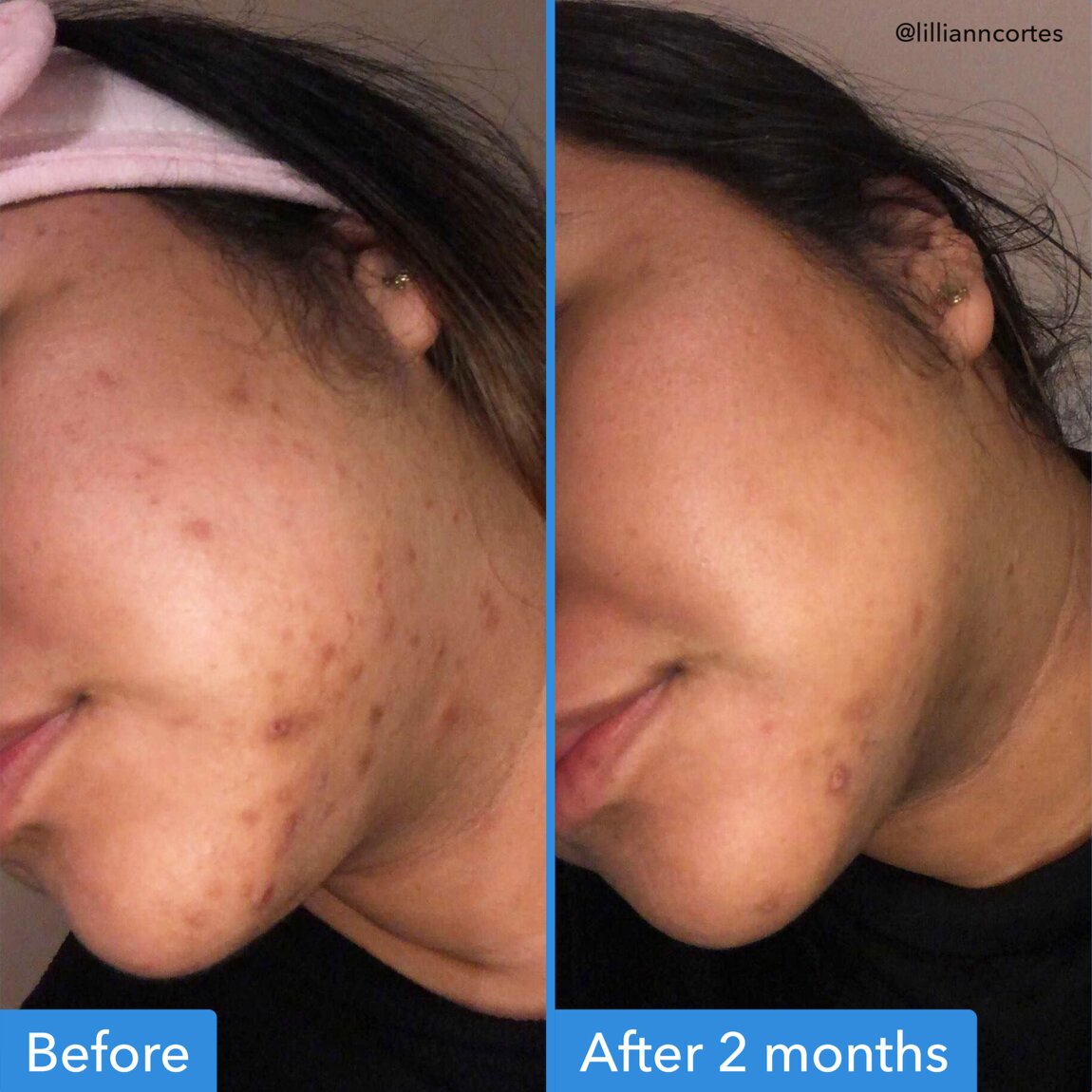 discoloration-correcting-serum-p6 zb_p.jpg